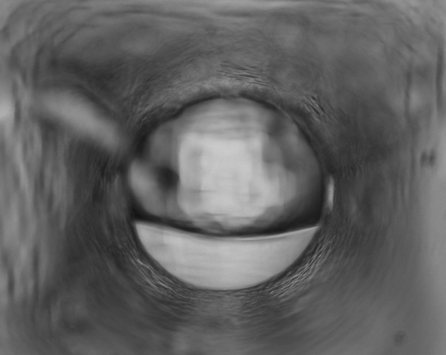 X0000100771492200806190920