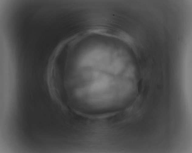 X0000100780337200807031236