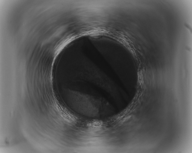 X0000100840196200806201158