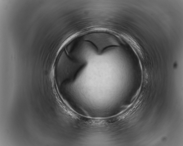 X0000100841198200806271105