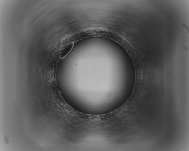 X0000100840965200807111147