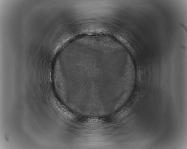 X0000100850399200807111221