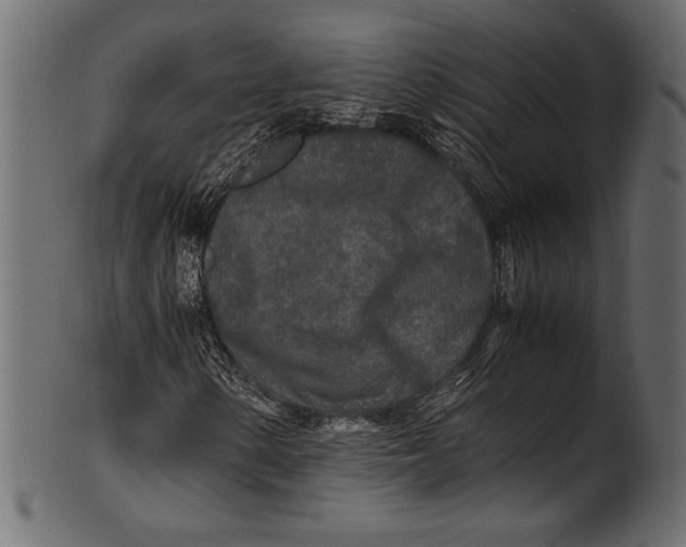 X0000100851154200807181050