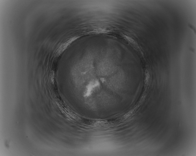 X0000100851161200807181050