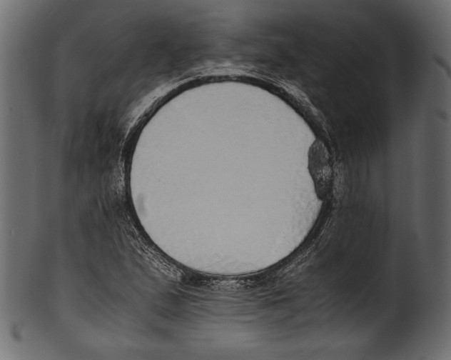 X0000100851167200807181050