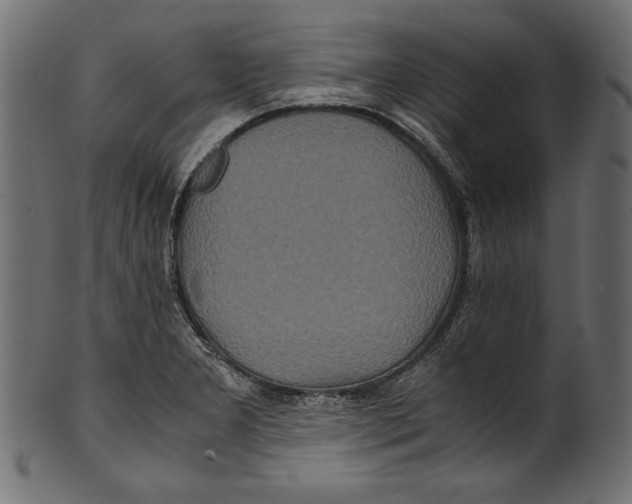X0000100851277200807181048