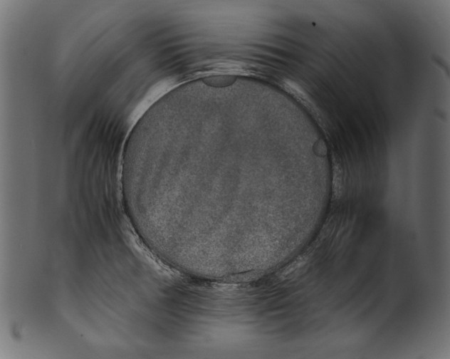 X0000100851378200807181046