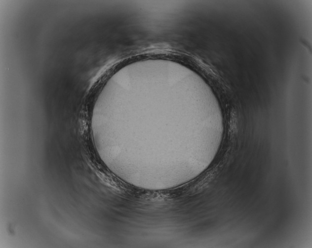 X0000100851400200807181045