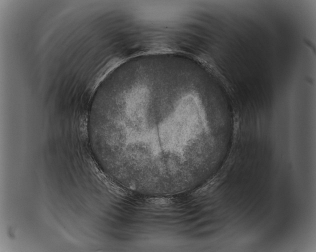 X0000100851409200807181046