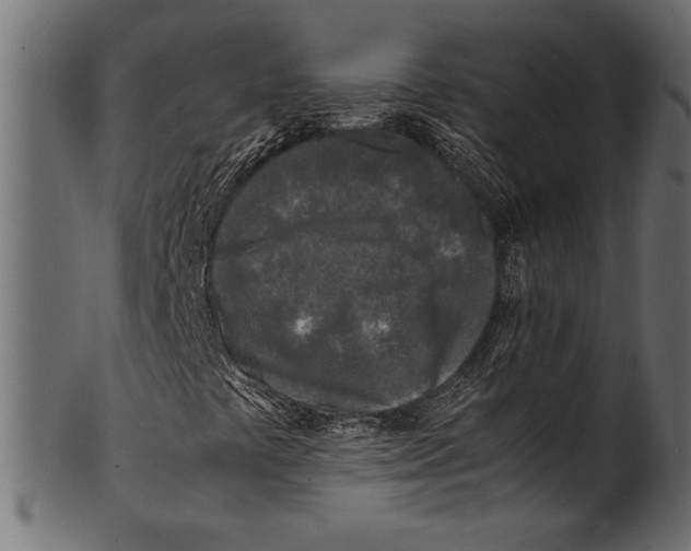 X0000100851441200807181045