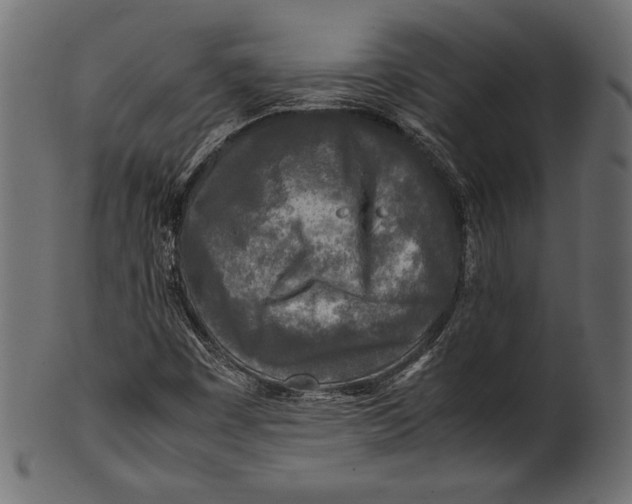 X0000100851449200807181045