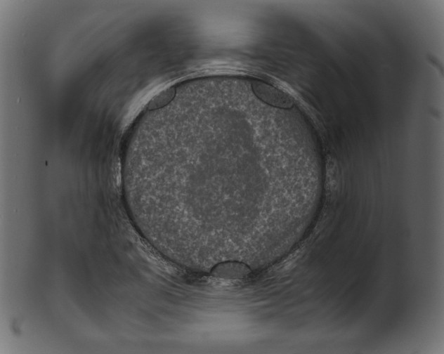 X0000100851461200807181045