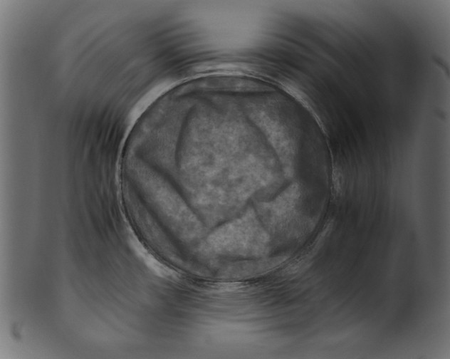 X0000100851482200807181045