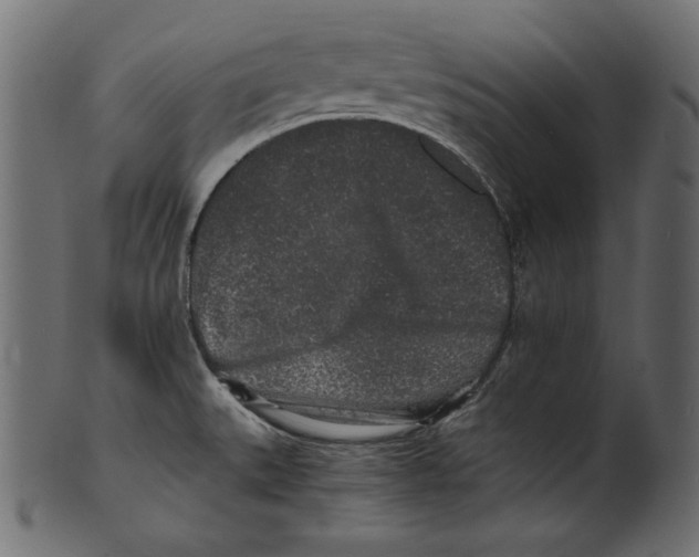X0000100851527200807181045