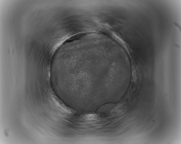 X0000100860059200807070944