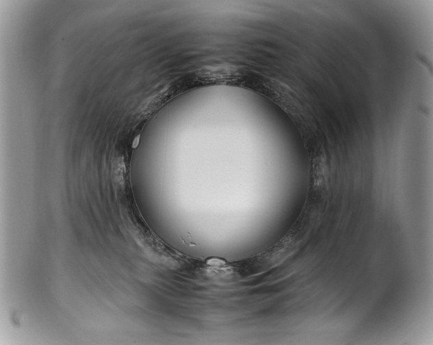 X0000100860279200807070941