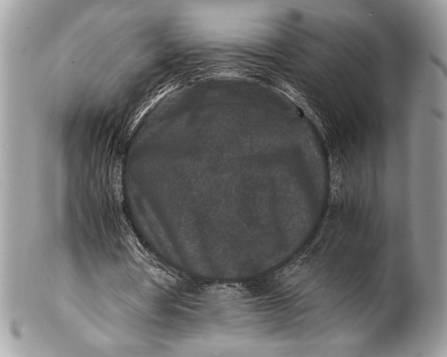 X0000100860386200807070939