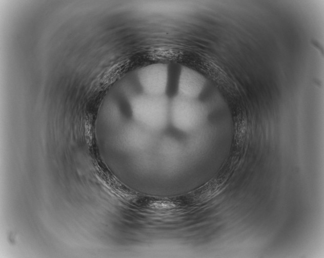 X0000100860749200807070933