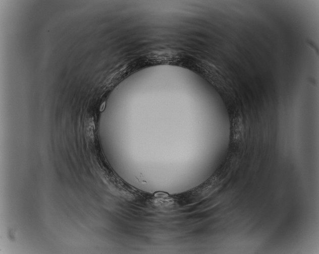 X0000100860279200807111301