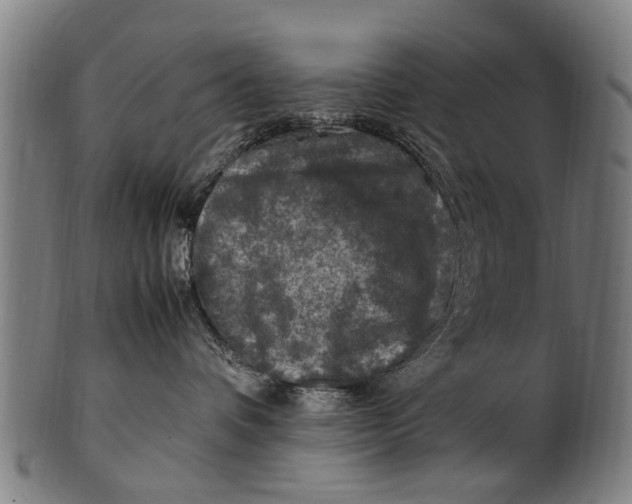 X0000100860336200807111259