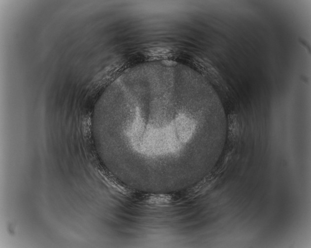 X0000100860369200807111259