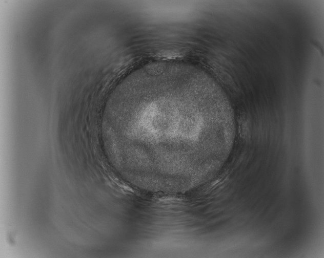 X0000100861393200807111241