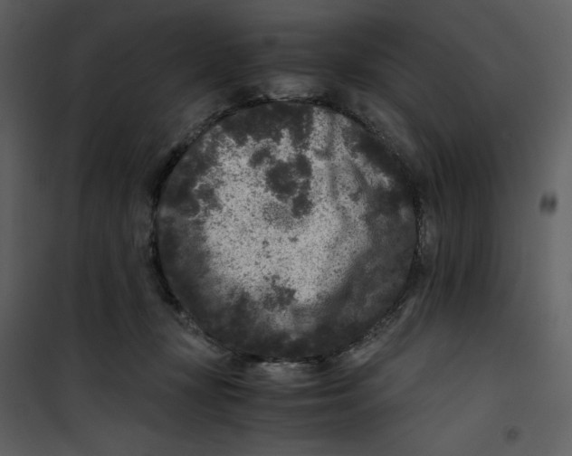 X0000100860367200807181141