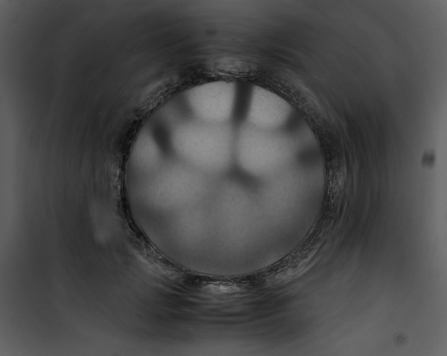 X0000100860749200807181135