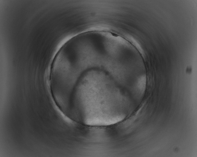 X0000100861103200807181130