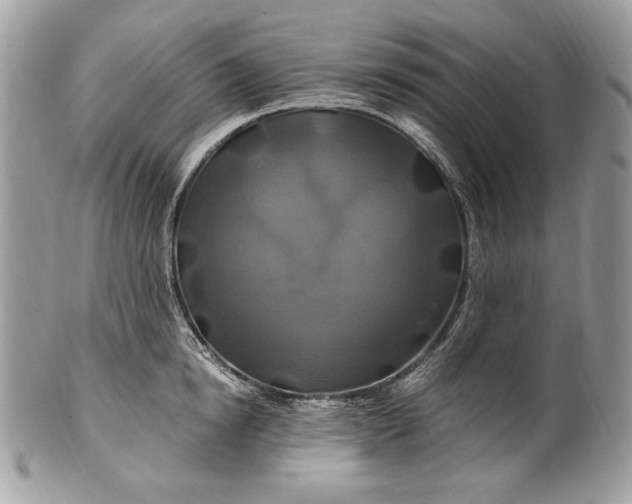 X0000100880854200807071124