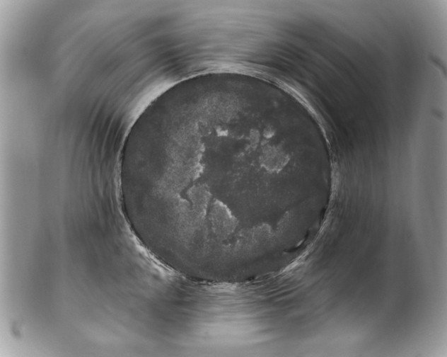 X0000100881048200807071122