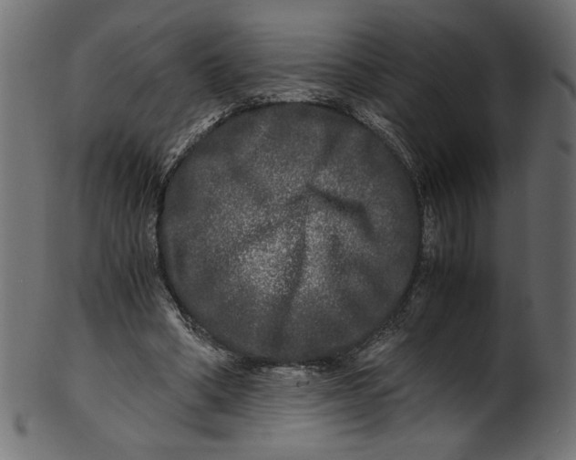 X0000100880394200807181304