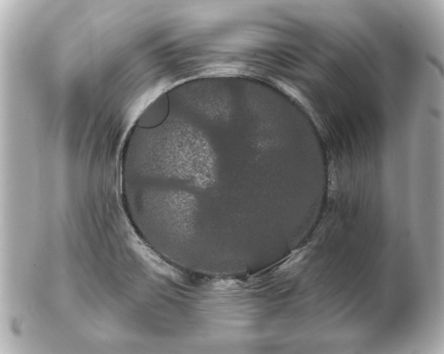 X0000100891467200807011146