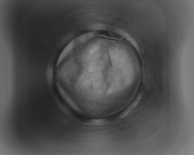 X0000100890057200807151106