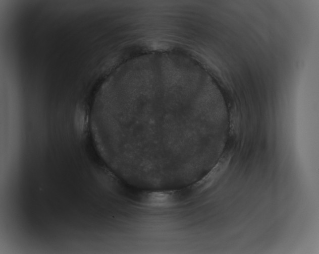 X0000100890176200807151105