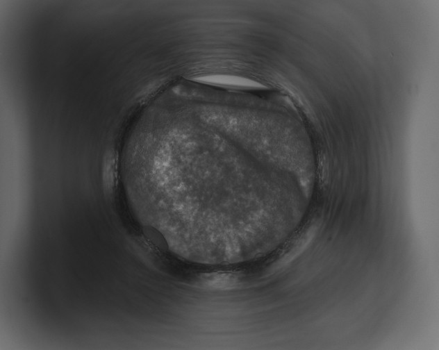 X0000100890356200807151102