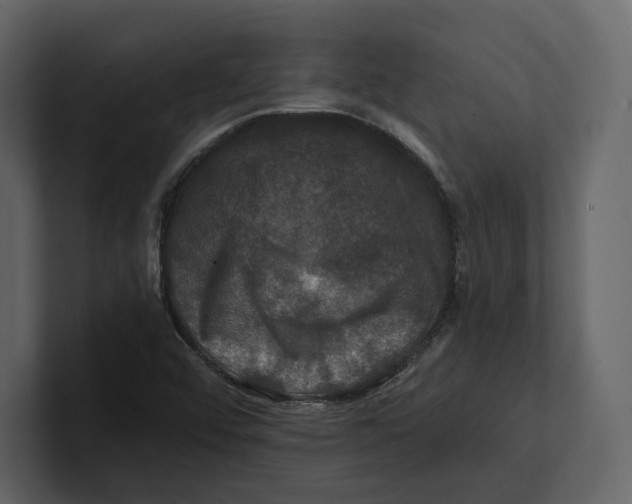 X0000100891456200807151047