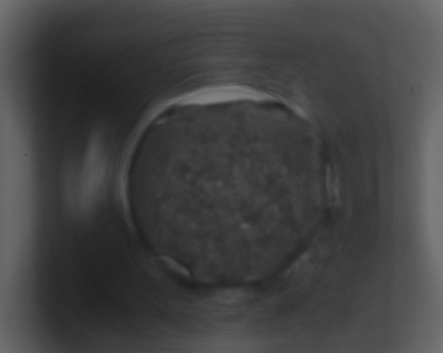 X0000100900099200807081111