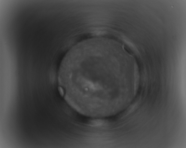 X0000100900417200807081107