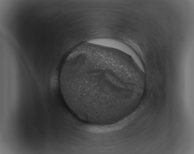 X0000100900017200807151127