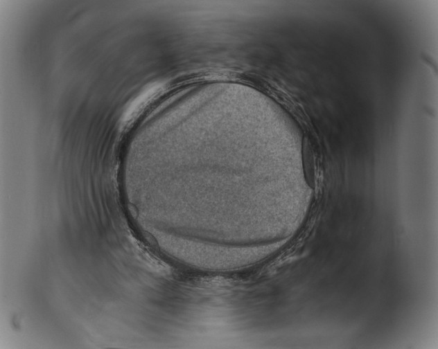 X0000100900197200807221000