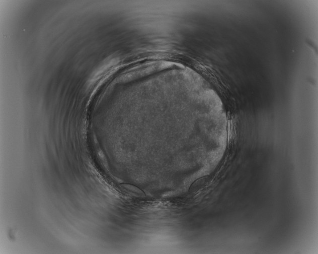 X0000100900243200807220958