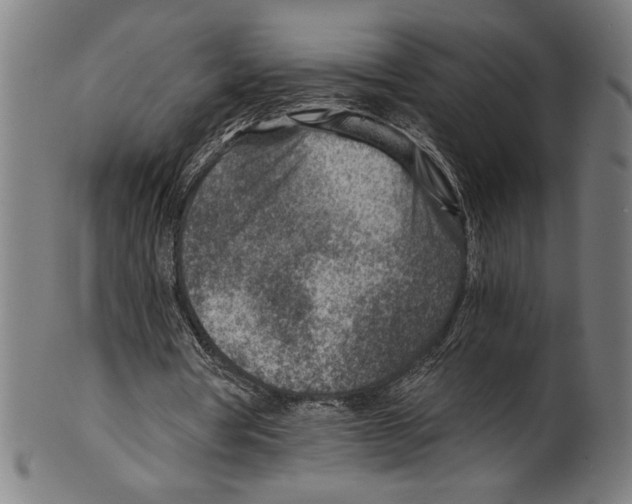 X0000100900386200807220957