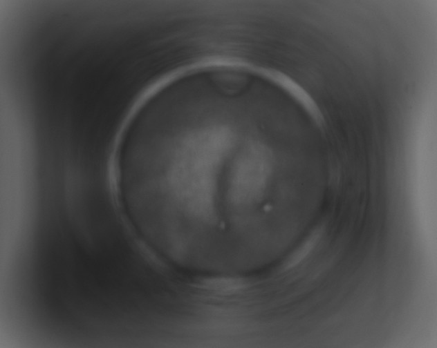 X0000100911287200807081116