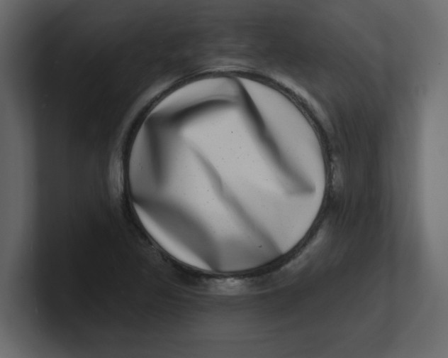 X0000100911317200807151130