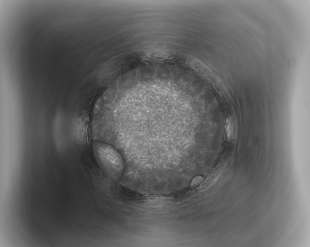 X0000100911059200807220946