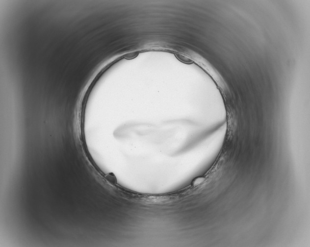 X0000100911148200807220945