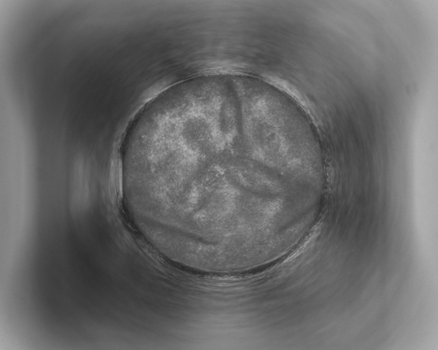 X0000100911219200807220944