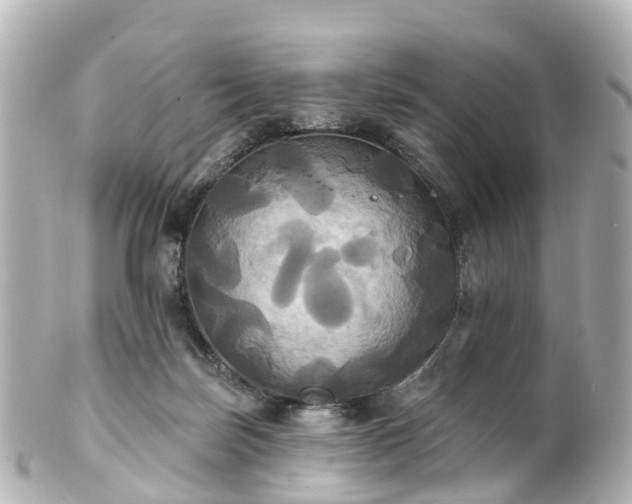 X0000100920171200807011315