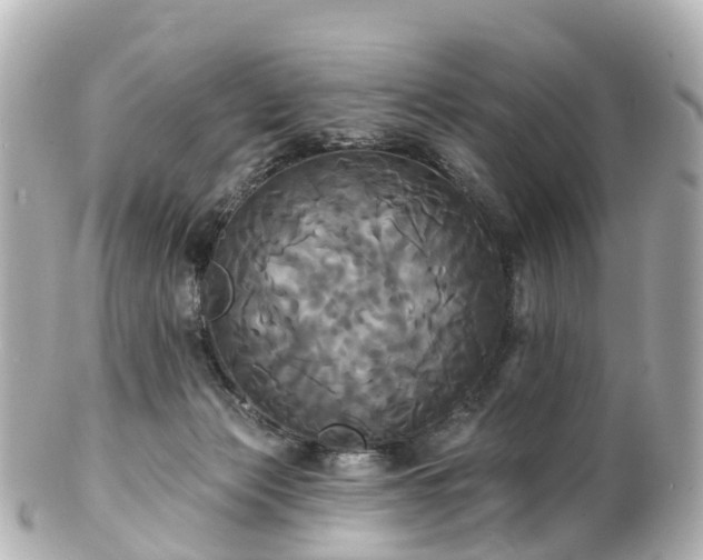 X0000100920173200807011315